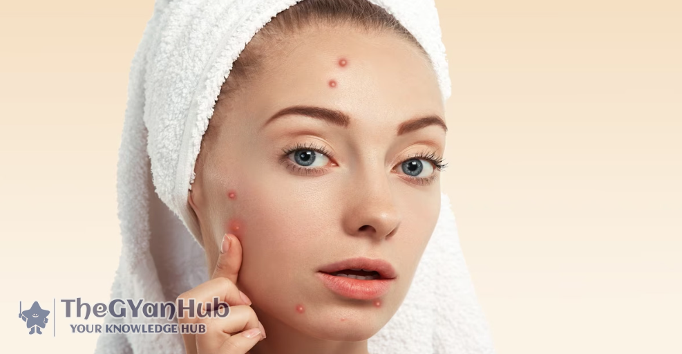 चेहरे के दाने गायब करने के अचूक उपाय-