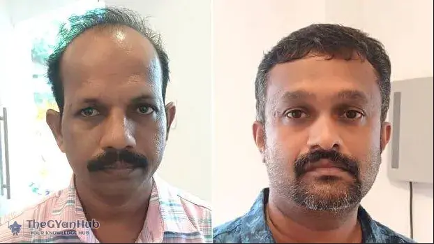 Kerala police arrest man accused of embezzling Rs 3.5 crore from private college