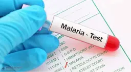 Innovate with ICMR: Malaria Detection Technology Initiative